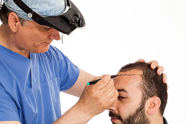 Hair transplant surgery