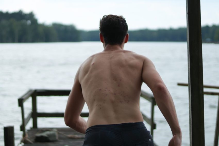 Back Ache