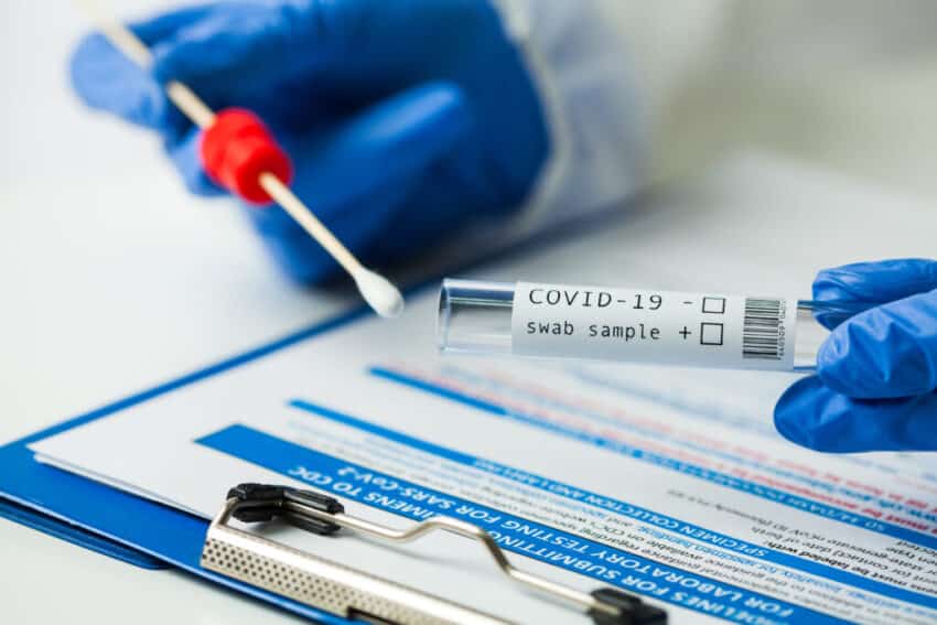 PCR test
