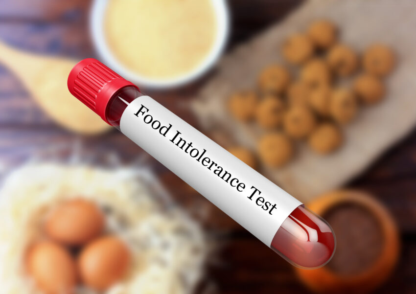 Blood,Sample,In,Test,Tube,For,Food,Intolerance,Test,In