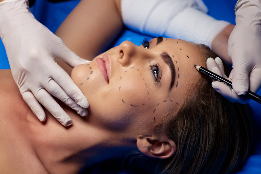 Woman,In,Surgery,Room,Lieing,On,Surgical,Table,For,Bueauty