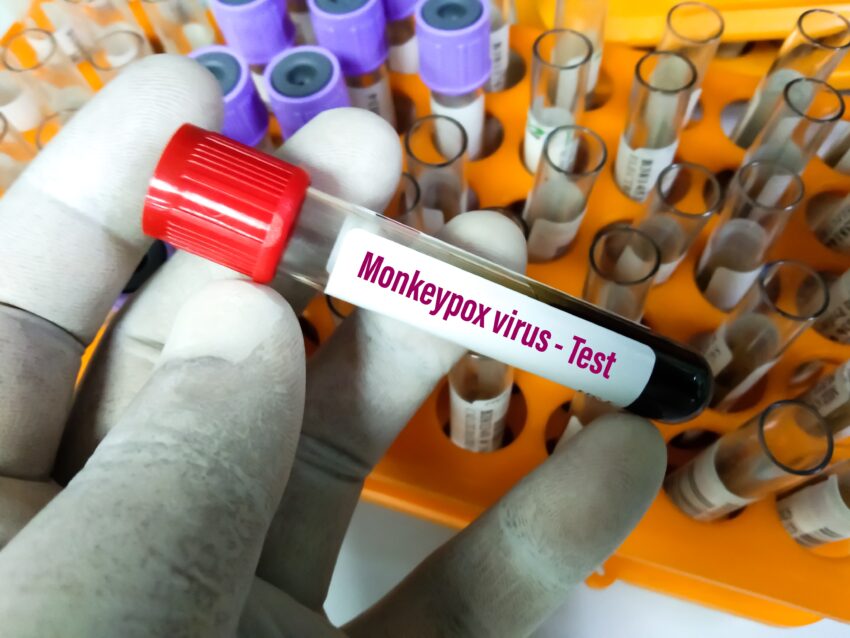 Blood,Sample,Tube,For,Monkeypox,Virus,Test.,It,Is,Also